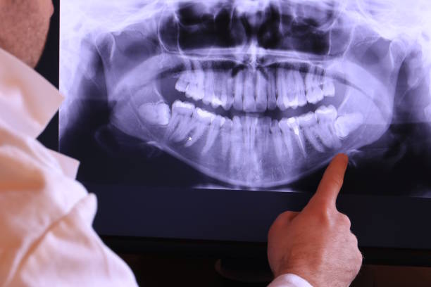 Best Emergency Dental Services for Seniors in Ronan, MT